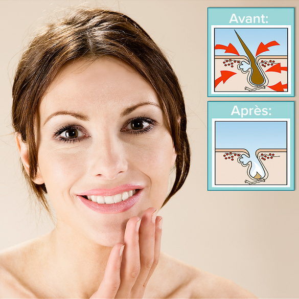 Crème dépilatoire visage