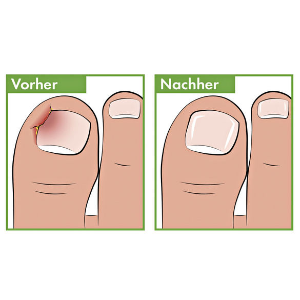 Lime de pédicure pour les coins Vital Comfort