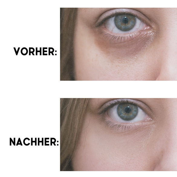 Roll-on contour des yeux