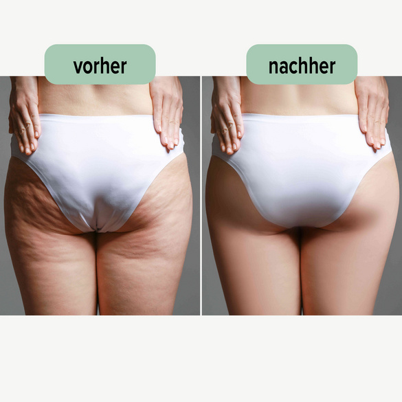 Crème chauffante minceur/anti-cellulite